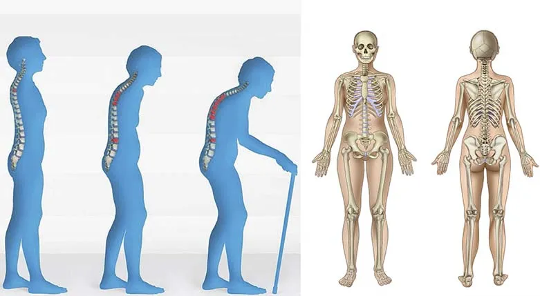151111-riksforeningenOsteopet