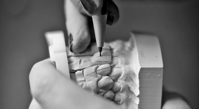 154044 - OralEstetik2