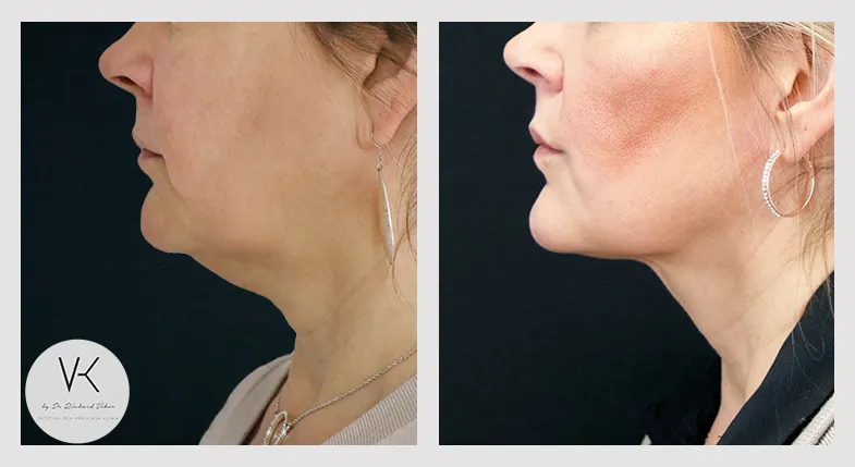 __Collage1_utan text