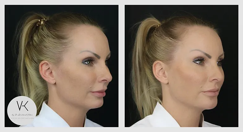 __Collage2_utan text